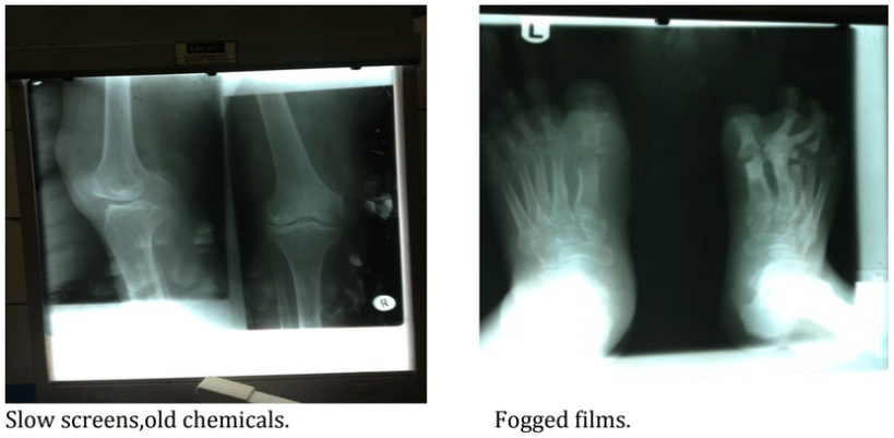 1st x-rays.PNG