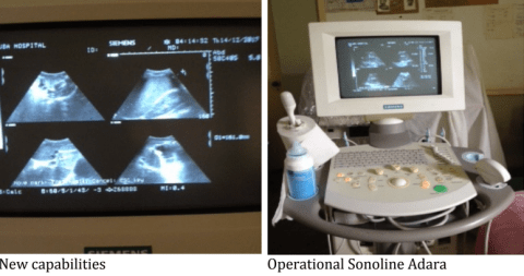 sonoscope in use.PNG